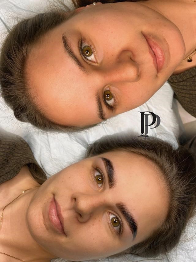 Browlamination